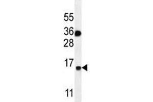 S100A1 antibody western blot analysis in MDA-MB435 lysate.