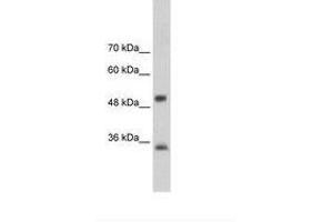 Image no. 2 for anti-Aryl Hydrocarbon Receptor Interacting Protein (AIP) (AA 101-150) antibody (ABIN202262)