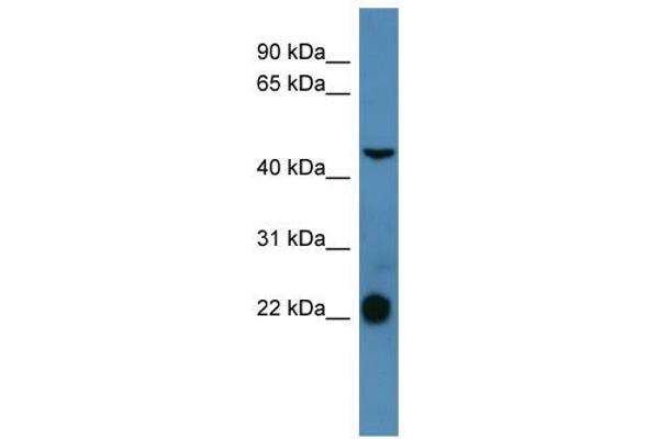 anti-Somatostatin Receptor 1 (SSTR1) (C-Term) antibody