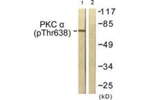Western blot analysis of extracts from NIH-3T3 cells treated with UV 15', using PKC alpha (Phospho-Thr638) Antibody.