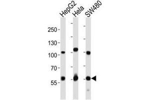 Image no. 6 for anti-Proprotein Convertase Subtilisin/kexin Type 9 (PCSK9) (AA 144-173) antibody (ABIN3032339)