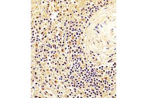 Image no. 1 for anti-Non-Metastatic Cells 1, Protein (NM23A) Expressed in (NME1) antibody (ABIN1882270)