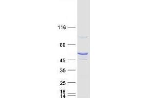 Image no. 1 for tRNA Methyltransferase 11 Homolog (Trmt11) protein (Myc-DYKDDDDK Tag) (ABIN2734345)