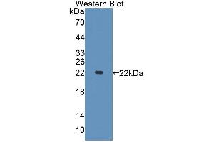 Image no. 1 for anti-PHD Finger Protein 8 (PHF8) (AA 195-351) antibody (ABIN1869797)