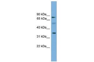 Image no. 1 for anti-Organic Solute Transporter alpha (OSTALPHA) (Middle Region) antibody (ABIN633166)