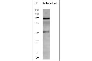 Image no. 5 for anti-Transient Receptor Potential Cation Channel, Subfamily V, Member 4 (TRPV4) (1st Cytoplasmic Loop) antibody (ABIN350026)