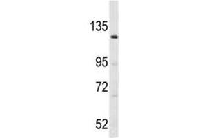 Image no. 3 for anti-LATS, Large Tumor Suppressor, Homolog 1 (Drosophila) (LATS1) (AA 1-30) antibody (ABIN3031593)