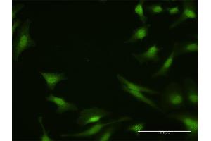 Image no. 4 for anti-Protein Phosphatase 2A Activator, Regulatory Subunit 4 (PPP2R4) (AA 1-323) antibody (ABIN519124)