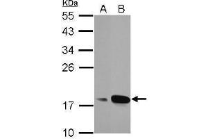 Image no. 1 for anti-Anterior Gradient 3 (AGR3) (Center) antibody (ABIN2854800)