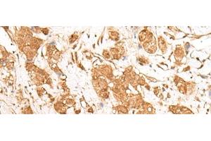 GANC antibody