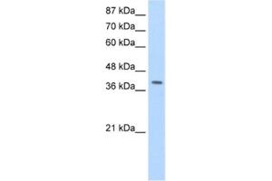 Image no. 1 for anti-La Ribonucleoprotein Domain Family, Member 7 (LARP7) antibody (ABIN2462269)