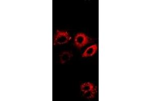 Image no. 3 for anti-Aldehyde Dehydrogenase 4 Family, Member A1 (ALDH4A1) (full length) antibody (ABIN6005034)