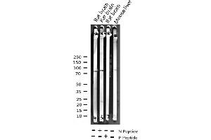 Image no. 2 for anti-Protein Kinase C, delta (PKCd) (pTyr313) antibody (ABIN6255881)
