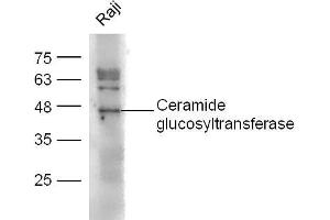 Image no. 3 for anti-UDP-Glucose Ceramide Glucosyltransferase (UGCG) (AA 21-120) antibody (ABIN672096)