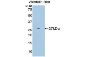 Image no. 1 for anti-DIX Domain Containing 1 (DIXDC1) (AA 513-711) antibody (ABIN1858643)