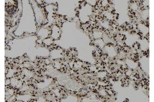 anti-Centrosomal Protein 164kDa (CEP164) (C-Term) antibody