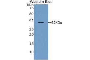 Image no. 3 for Filamin B, beta (FLNB) ELISA Kit (ABIN6574321)