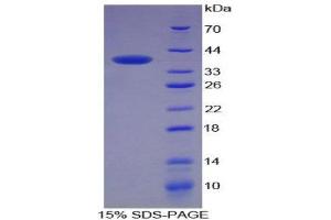 Image no. 1 for Keratin 4 (KRT4) (AA 152-457) protein (His tag) (ABIN1878870)