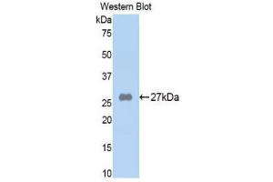 Image no. 1 for anti-alpha-2-Macroglobulin (A2M) (AA 818-1048) antibody (ABIN1857845)