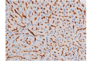 Image no. 7 for anti-Insulin Receptor Substrate 1 (IRS1) (pSer312) antibody (ABIN6256264)