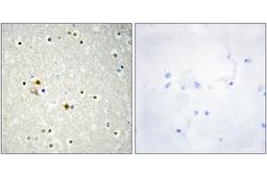 Image no. 2 for anti-Deoxyribonuclease I (DNASE1) (AA 111-160) antibody (ABIN1534439)