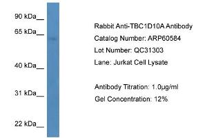 Image no. 2 for anti-TBC1 Domain Family, Member 10A (TBC1D10A) (C-Term) antibody (ABIN2788501)