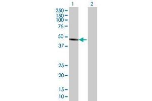 Image no. 1 for anti-Allantoicase (ALLC) (AA 1-409) antibody (ABIN527704)