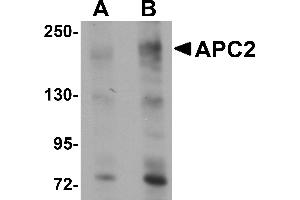 Image no. 2 for anti-APC Regulator of WNT Signaling Pathway 2 (APC2) (Middle Region) antibody (ABIN1030861)