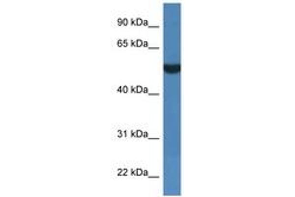 FSD1L anticorps  (AA 328-377)