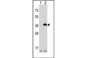 Image no. 3 for anti-Peroxisomal Biogenesis Factor 16 (PEX16) (AA 254-283), (Middle Region) antibody (ABIN954098)