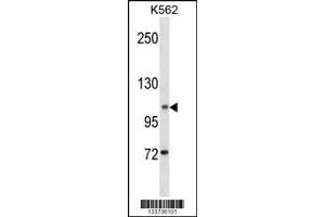 Western Blotting (WB) image for anti-Anoctamin 1, Calcium Activated Chloride Channel (ANO1) (Center) antibody (ABIN2159133)