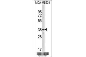 Image no. 1 for anti-MHC Class I Polypeptide-Related Sequence A (MICA) (AA 68-97) antibody (ABIN652566)