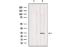 Image no. 1 for anti-RAB35, Member RAS Oncogene Family (RAB35) (Internal Region) antibody (ABIN6264573)