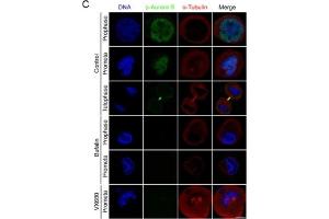 Bufalin prevents Aurora A recruitment to mitotic centrosomes and Aurora B recruitment to unattached kinetochores(A) HeLa cells were synchronized by a single thymidine treatment, released in the presence or absence of bufalin (100 nM) for 9 h, and stained for phospho-Aurora A (Green), α-tubulin (Red) and DNA (Blue).