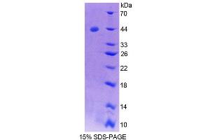 Image no. 1 for Syncollin (SYCN) (AA 38-134) protein (His tag,GST tag) (ABIN6237017)