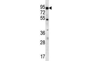 Image no. 1 for anti-Chemokine (C-C Motif) Ligand 17 (CCL17) (AA 553-582) antibody (ABIN5647610)