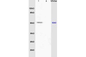 Image no. 2 for anti-Peroxisome Proliferator-Activated Receptor alpha (PPARA) (pSer12) antibody (ABIN753163)