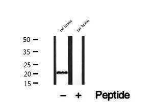 anti-Centrin, EF-Hand Protein, 2 (CETN2) (Internal Region) antibody
