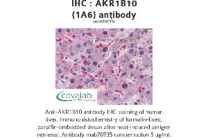 Image no. 1 for anti-Aldo-Keto Reductase Family 1, Member B10 (Aldose Reductase) (AKR1B10) (AA 76-144) antibody (ABIN1723592)