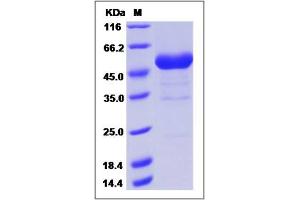 Image no. 1 for Ring Finger Protein 43 (RNF43) (AA 1-197) (Active) protein (Fc Tag) (ABIN2006725)