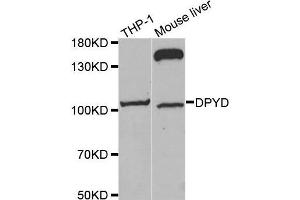 Image no. 2 for anti-Dihydropyrimidine Dehydrogenase (DPYD) antibody (ABIN3022259)