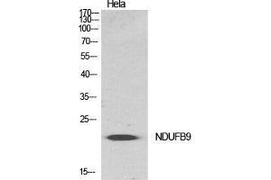 Image no. 2 for anti-NADH Dehydrogenase (Ubiquinone) 1 beta Subcomplex, 9, 22kDa (NDUFB9) (Internal Region) antibody (ABIN3185799)