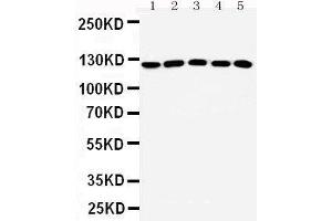 Image no. 1 for anti-Suppression of Tumorigenicity 5 (ST5) (AA 571-586), (Middle Region) antibody (ABIN3042548)