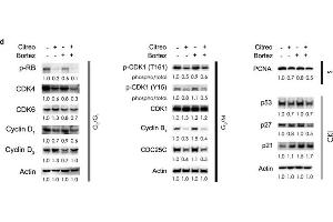 Image no. 7 for anti-Cyclin-Dependent Kinase Inhibitor 1B (p27, Kip1) (CDKN1B) (Center) antibody (ABIN2854753)