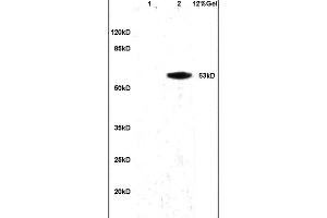 anti-Granulin (GRN) (AA 451-550) antibody
