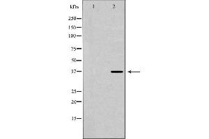 Image no. 1 for anti-Mitogen-Activated Protein Kinase Kinase 6 (MAP2K6) antibody (ABIN6263101)