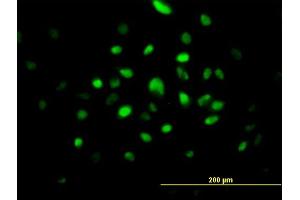 Immunofluorescence of purified MaxPab antibody to RNASEH2A on HeLa cell.