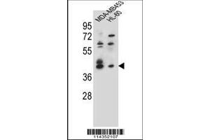 Image no. 1 for anti-SRY (Sex Determining Region Y)-Box 3 (SOX3) (AA 166-196) antibody (ABIN655392)