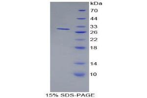 Image no. 1 for Bone Marrow Stromal Cell Antigen 1 (BST1) (AA 63-313) protein (His tag) (ABIN1879070)