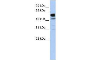 Image no. 1 for anti-Lactate Dehydrogenase D (LDHD) (Middle Region) antibody (ABIN2785274)
